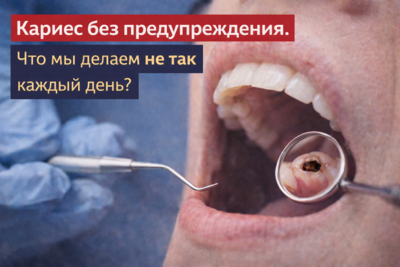 Кариес без предупреждения. Что мы делаем не так каждый день?